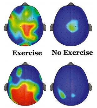 Exercise and ADHD